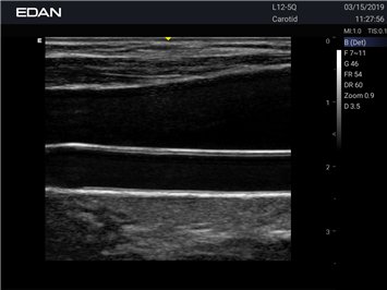 20191029045903_923118