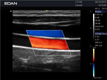 20191029045904_079385