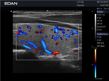 20191029045905_313768