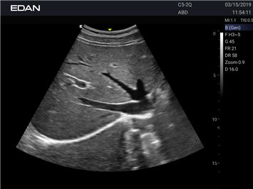 20191029045906_345039