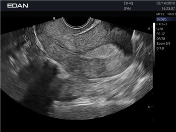 20191029045910_313752