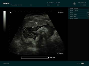 20191030085352_721939