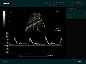 20191030085407_503197