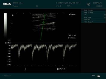20191030085407_643797