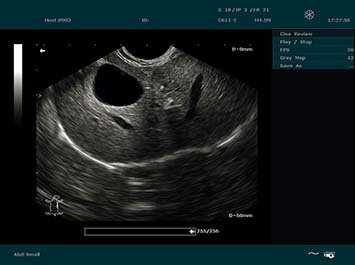 20191030085534_487550