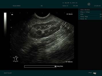 20191030085534_550169