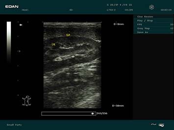 20191030085534_596923