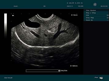 20191030085534_893801