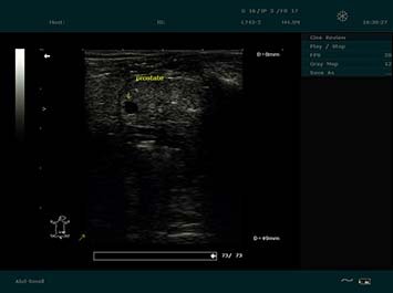 20191030085534_987536