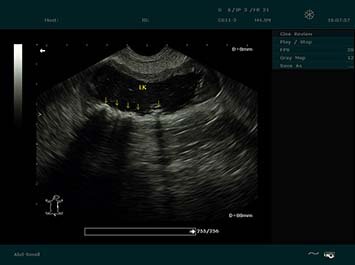 20191030085535_300067