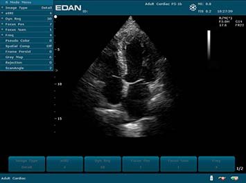 20191030085942_753206