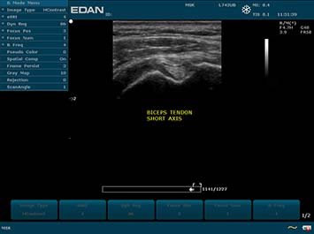 20191030085943_690676