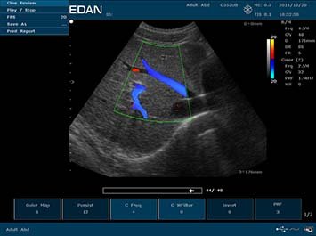 20191030085945_909447