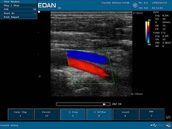 20191030085946_331309