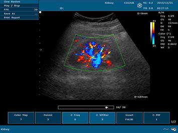 20191030085947_425080