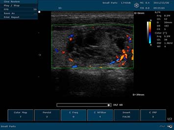 20191030085951_456318