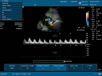 20191030085951_800047