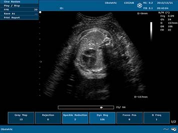 20191030085951_862549