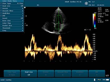 20191030085952_237561