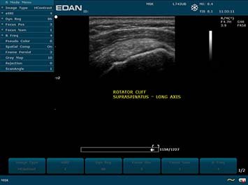 20191030085952_721944