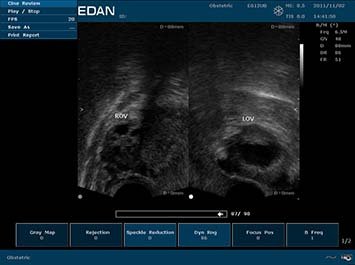 20191030085956_612556