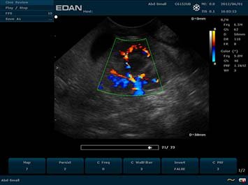 20191030090122_440674