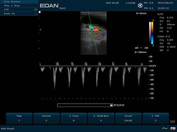 20191030090122_628205