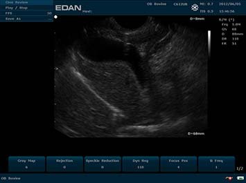 20191030090122_721930