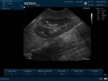 20191030090123_221938