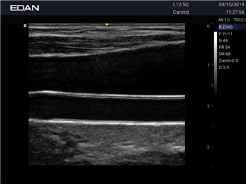 20191101031647_143790