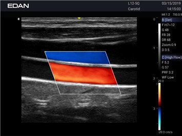 20191101031647_846956