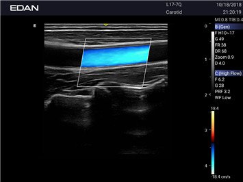 20191101031648_721946