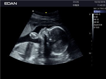 20191101031649_237561