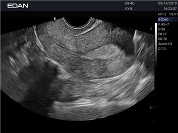 20191101031650_425060