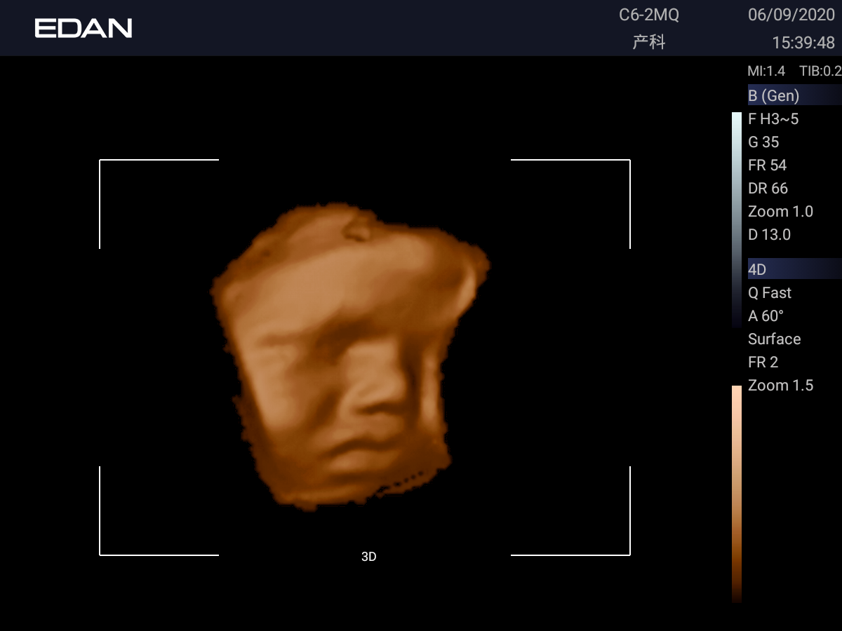 20201105111232_302130